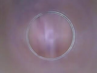 Dildocam – Thin Brunette Showing Her medical person Vagina Cervix | xHamster